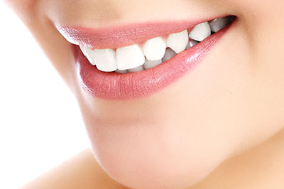 Modern Dental Care of Queens | Dental Fillings, Dental Bridges and ZOOM  Whitening