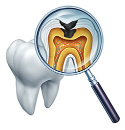Modern Dental Care of Queens | Emergency Treatment, Laser Dentistry and Preventative Program