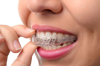 Modern Dental Care of Queens | Veneers, Oral Exams and Dental Bridges